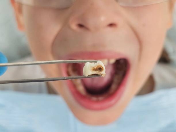 Best Emergency Dental Care for Trauma or Injury in Attla, AL